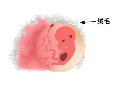 新生儿青囊(新生儿囊肿需要做手术吗)