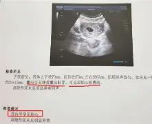 宝宝青囊(青囊长什么样子)