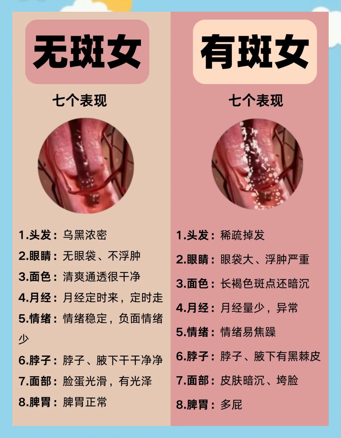脸上长黄褐斑看什么科 脸上长黄褐斑看什么科