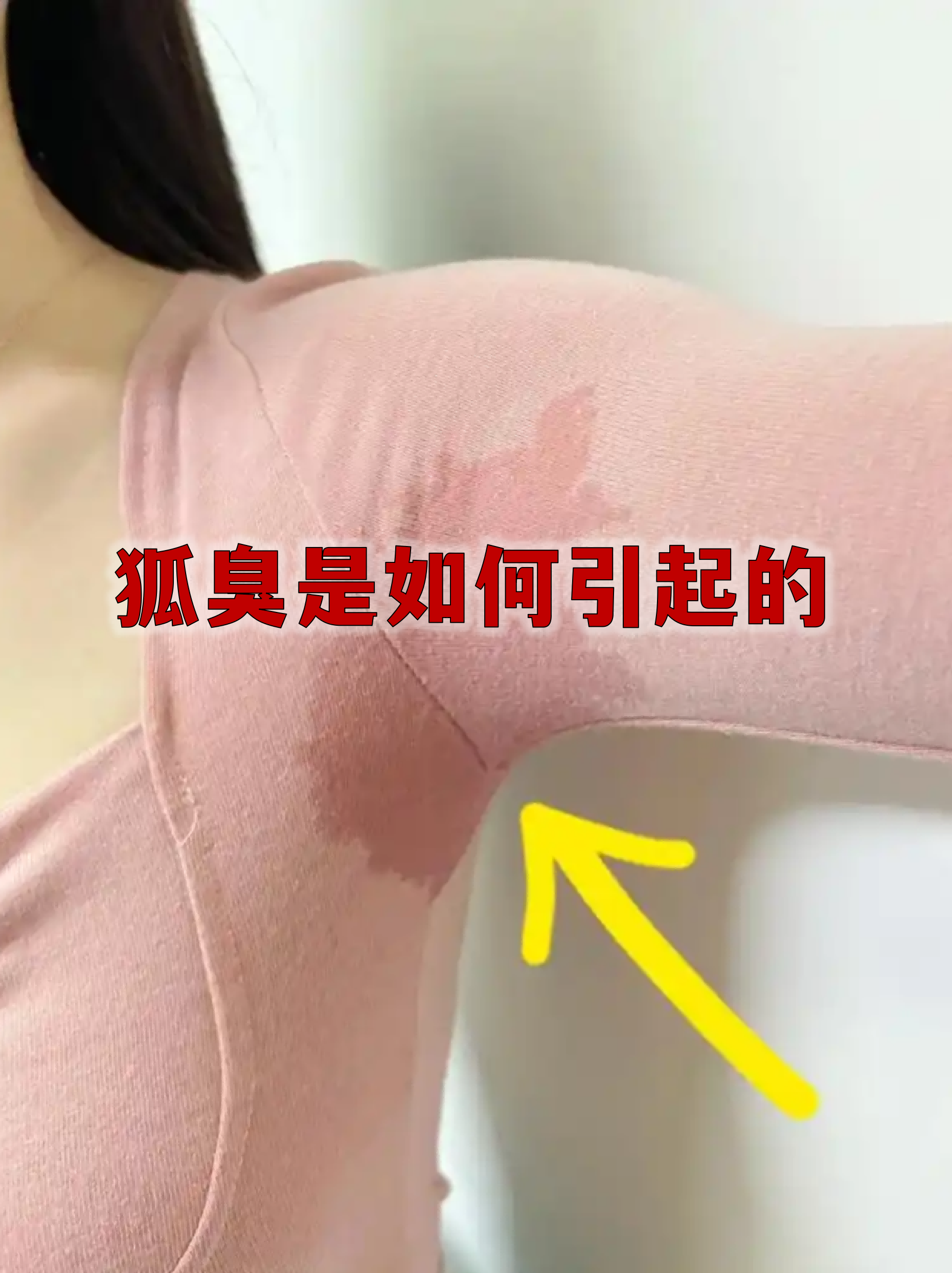 有狐臭的女生是什么原因引起的 有狐臭的女生是什么原因引起的