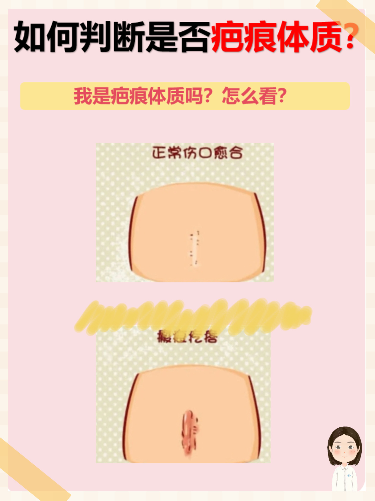 怎么判断自己有狐臭口渴症状