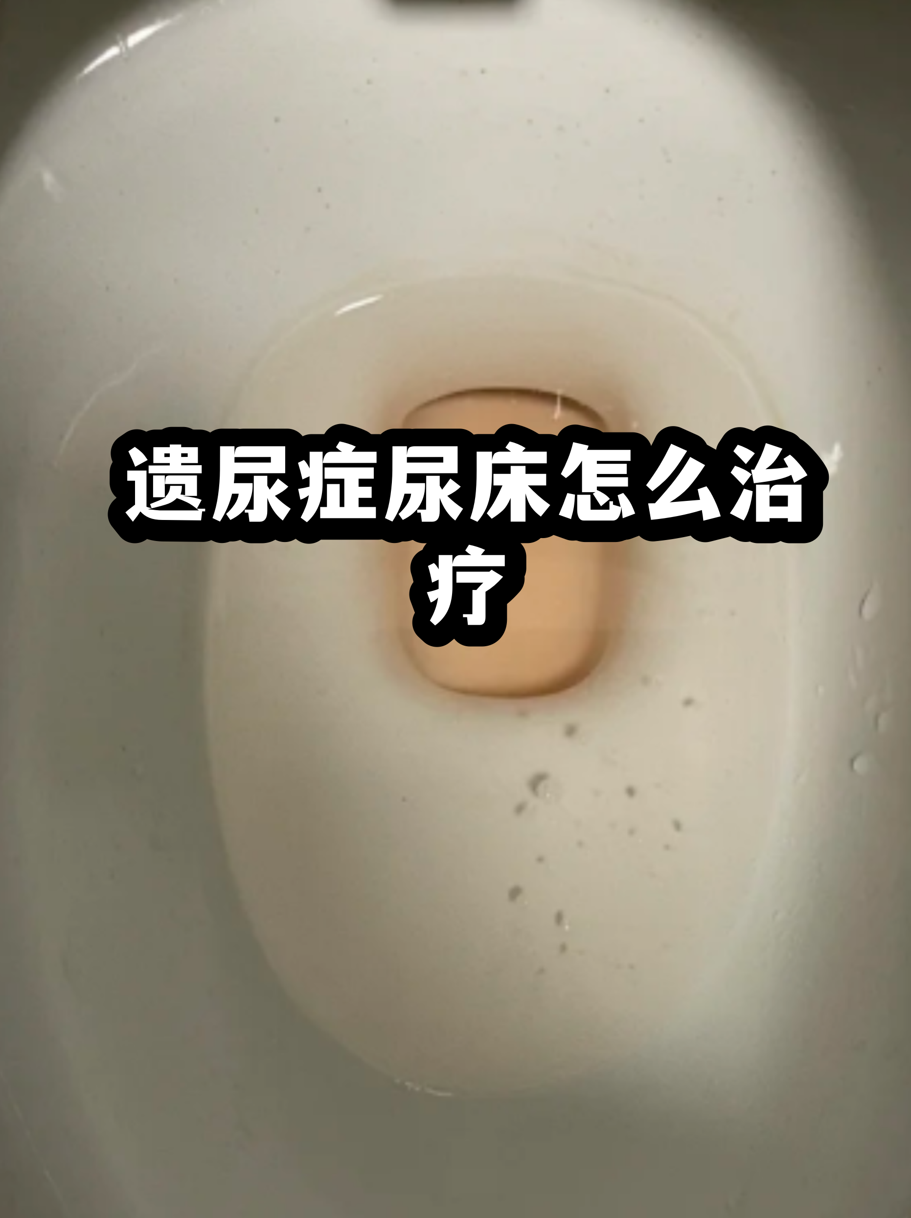 小孩老是尿床有什么好方法呢的简单介绍