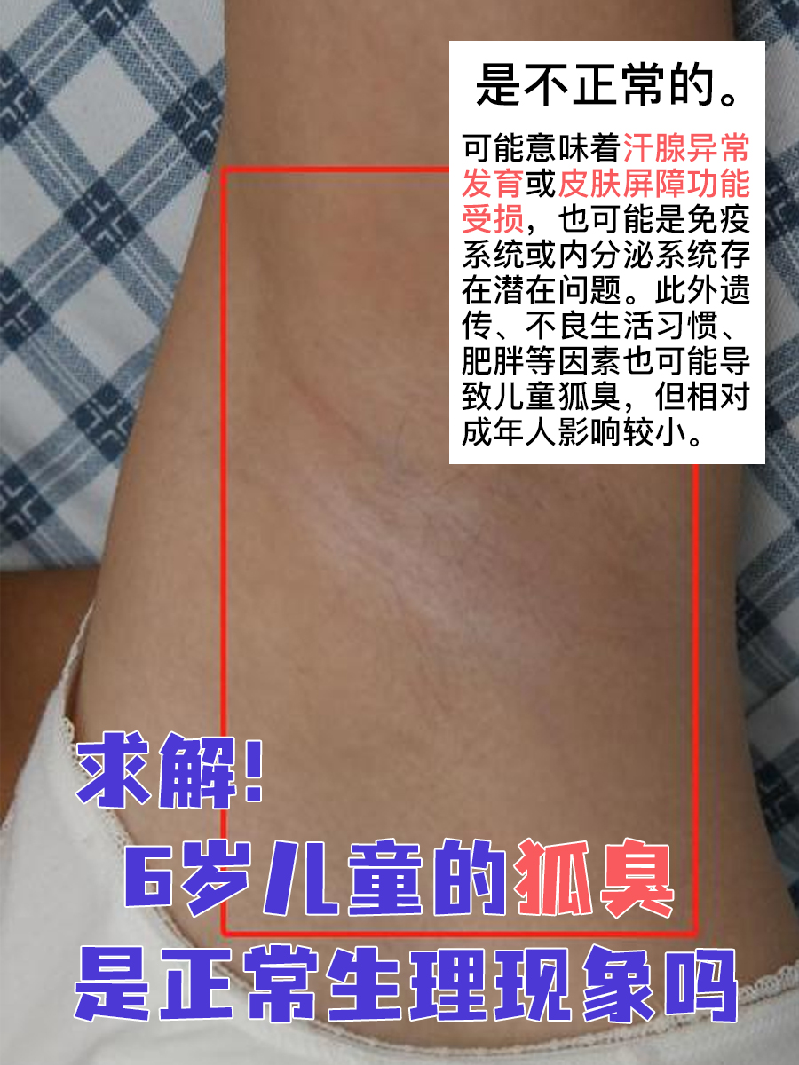 青春期假性狐臭